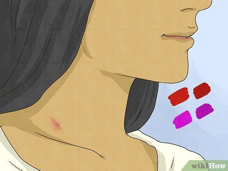 love bite on breast|How to Spot a Hickey (8 Telltale Signs)